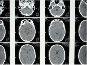 FMRI Scans - Chunking is better than multitasking